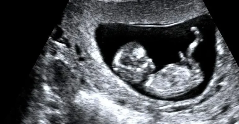 11-14 Hafta Ultrasonografisi