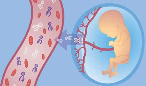 Fetal Kan Örneklemesi (FKÖ) (Kordosentez)